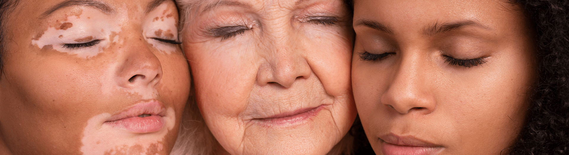 Skin Pigmentation Treatments at NuHealth
